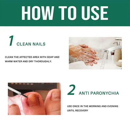 Anti-Paronychia Relief Oil  (BUY 1 GET 1 FREE).